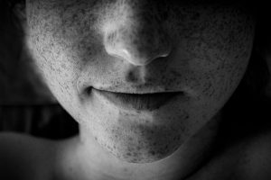 Artistic black and white close-up of a face highlighting freckles and lips. — Enhancing Security With a Private Photo Viewer